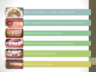 Plaque retentive factors – calculus – most important
Others, subgingival and over hanging margins of restorations,
Subgingivally extending carious lesions,
Furcation involvements, cervical enamel projection.,
Crowded and mal-aligned teeth,
Root grooves and concavities
 