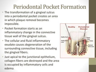 Periodontal Pocket Formation
• The transformation of a gingival sulcus
into a periodontal pocket creates an area
in which plaque removal becomes
impossible.
• Pocket formation starts as an
inflammatory change in the connective
tissue wall of the gingival sulcus.
• The cellular and fluid inflammatory
exudate causes degeneration of the
surrounding connective tissue, including
the gingival fibers.
• Just apical to the junctional epithelium,
collagen fibers are destroyed and the area
is occupied by inflammatory cells and
edema.
 