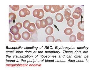 Chronic Poisoning in Children | PPT