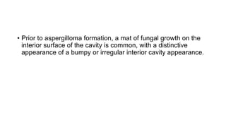 • Prior to aspergilloma formation, a mat of fungal growth on the
interior surface of the cavity is common, with a distinctive
appearance of a bumpy or irregular interior cavity appearance.
 