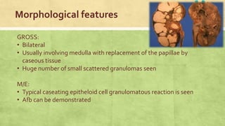 Morphological features
GROSS:
• Bilateral
• Usually involving medulla with replacement of the papillae by
caseous tissue
• Huge number of small scattered granulomas seen
M/E:
• Typical caseating epitheloid cell granulomatous reaction is seen
• Afb can be demonstrated
 