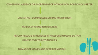 CONGENITAL ABSENCE OR SHORTENING OF INTRAVESICAL PORTION OF URETER
URETER NOT COMPRESSED DURING MICTURITION
REFLUX OF URINE INTO URETERS
REFLUX RESULTS IN INCREASE IN PRESSURE IN PELVIS SOTHAT
URINE IS FORCED INTOTUBULES
DAMAGE OF KIDNEY AND SCAR FORMATION
 