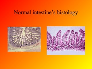 Normal Intestines Ir Management of Chronic Radiation Enteritis.ppt