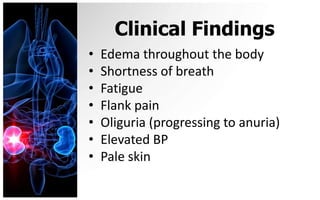 Clinical Findings
•   Edema throughout the body
•   Shortness of breath
•   Fatigue
•   Flank pain
•   Oliguria (progressing to anuria)
•   Elevated BP
•   Pale skin
 