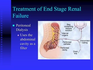 Treatment of End Stage Renal
Failure
 Peritoneal
Dialysis
 Uses the
abdominal
cavity as a
filter
 