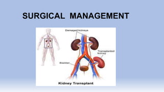 SURGICAL MANAGEMENT
 