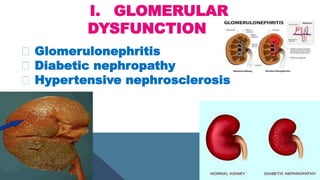 I. GLOMERULAR
DYSFUNCTION
Glomerulonephritis
Diabetic nephropathy
Hypertensive nephrosclerosis
 