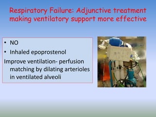 Respiratory Failure: Adjunctive treatment
making ventilatory support more effective
• NO
• Inhaled epoprostenol
Improve ventilation- perfusion
matching by dilating arterioles
in ventilated alveoli
 