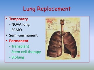 Lung Replacement
• Temporary
- NOVA lung
- ECMO
• Semi-permanent
• Permanent
- Transplant
- Stem cell therapy
- Biolung
 