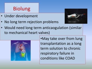 Biolung
• Under development
• No long term rejection problems
• Would need long term anticaogulation (similar
to mechanical heart valves)
•May take over from lung
transplantation as a long
term solution to chronic
respiratory failure in
conditions like COAD
 