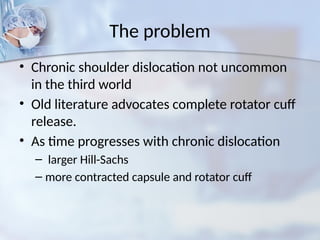 The problem
• Chronic shoulder dislocation not uncommon
in the third world
• Old literature advocates complete rotator cuff
release.
• As time progresses with chronic dislocation
– larger Hill-Sachs
– more contracted capsule and rotator cuff
 