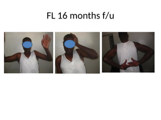 FL 16 months f/u
 