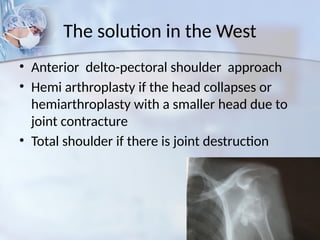 The solution in the West
• Anterior delto-pectoral shoulder approach
• Hemi arthroplasty if the head collapses or
hemiarthroplasty with a smaller head due to
joint contracture
• Total shoulder if there is joint destruction
 