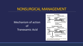 NONSURGICAL MANAGEMENT
Mechanism of action
of
Tranexamic Acid
 