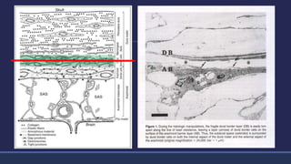 Devoid of collagen and has only
a few intercellular junctions
causing inherent weakness
 