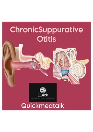 ChronicSuppurativeOtitis.pdf ENT  by QuickMedTalk