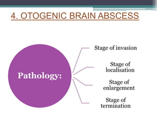 4. OTOGENIC BRAIN ABSCESS
Pathology:
Stage of invasion
Stage of
localisation
Stage of
enlargement
Stage of
termination
 