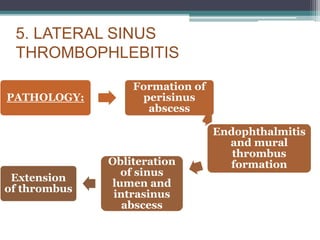 5. LATERAL SINUS
THROMBOPHLEBITIS
PATHOLOGY:
Formation of
perisinus
abscess
Endophthalmitis
and mural
thrombus
formation
Obliteration
of sinus
lumen and
intrasinus
abscess
Extension
of thrombus
 