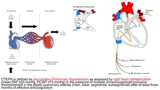 Chronic Thrombo Embolic Pulmonary Hypertension.pptx