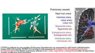 Chronic Thrombo Embolic Pulmonary Hypertension.pptx