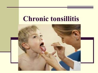 Chronic tonsillitis 