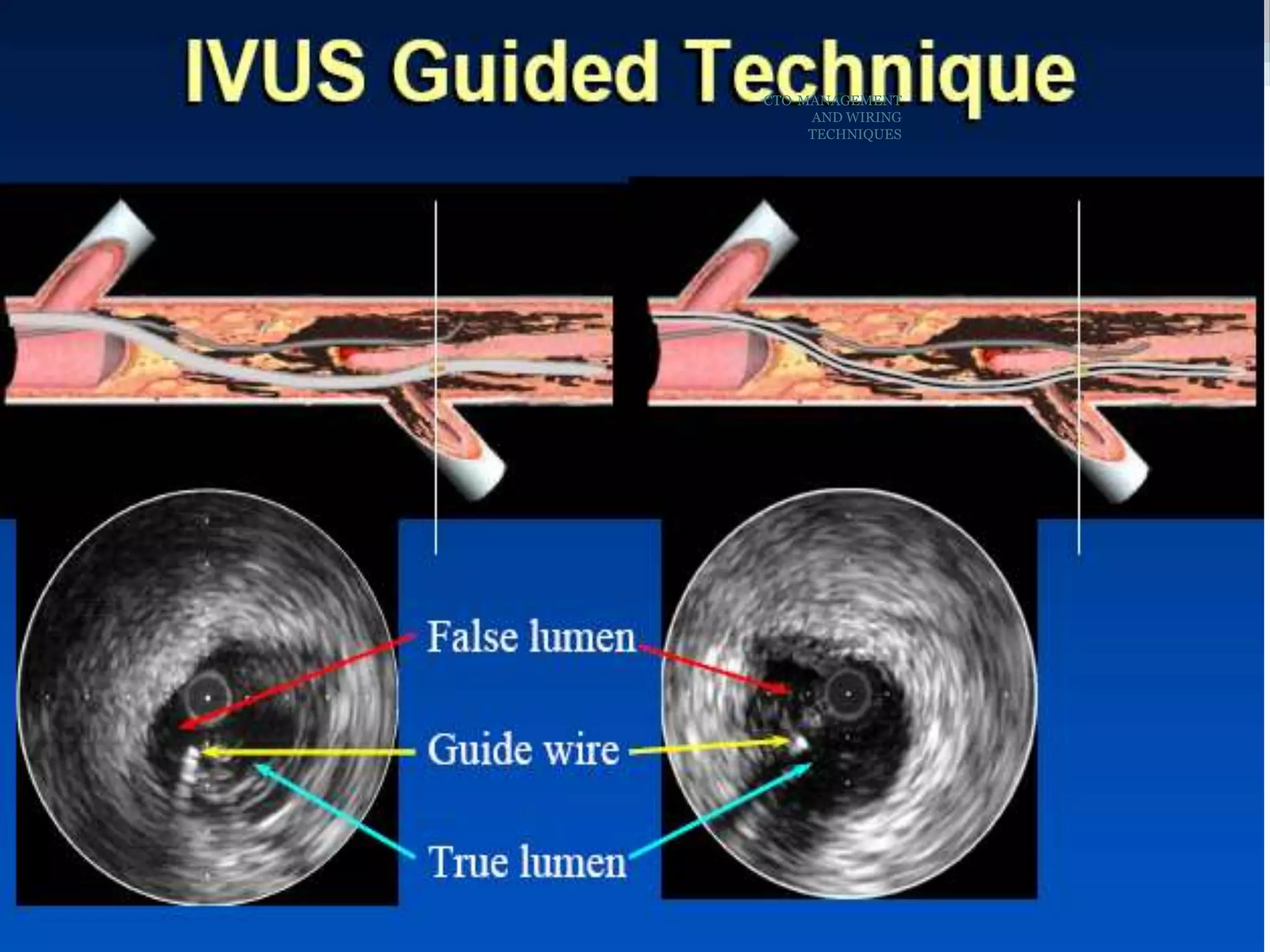 CTO-MANAGEMENT
AND WIRING
TECHNIQUES
 