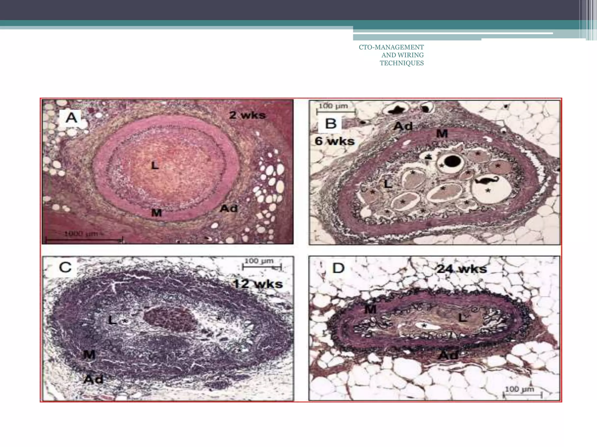 CTO-MANAGEMENT
AND WIRING
TECHNIQUES
 
