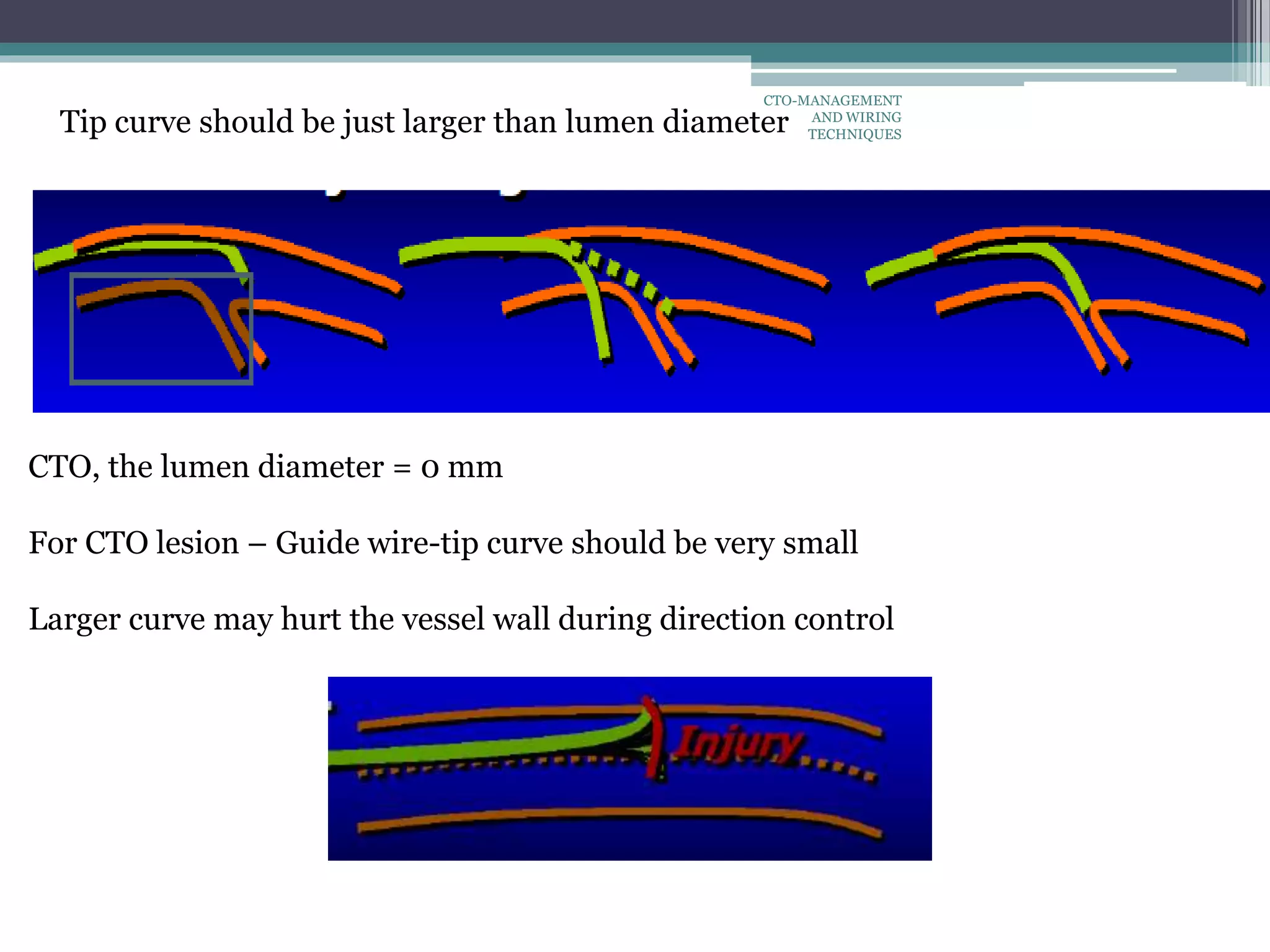 Tip curve should be just larger than lumen diameter
CTO, the lumen diameter = 0 mm
For CTO lesion – Guide wire-tip curve should be very small
Larger curve may hurt the vessel wall during direction control
CTO-MANAGEMENT
AND WIRING
TECHNIQUES
 