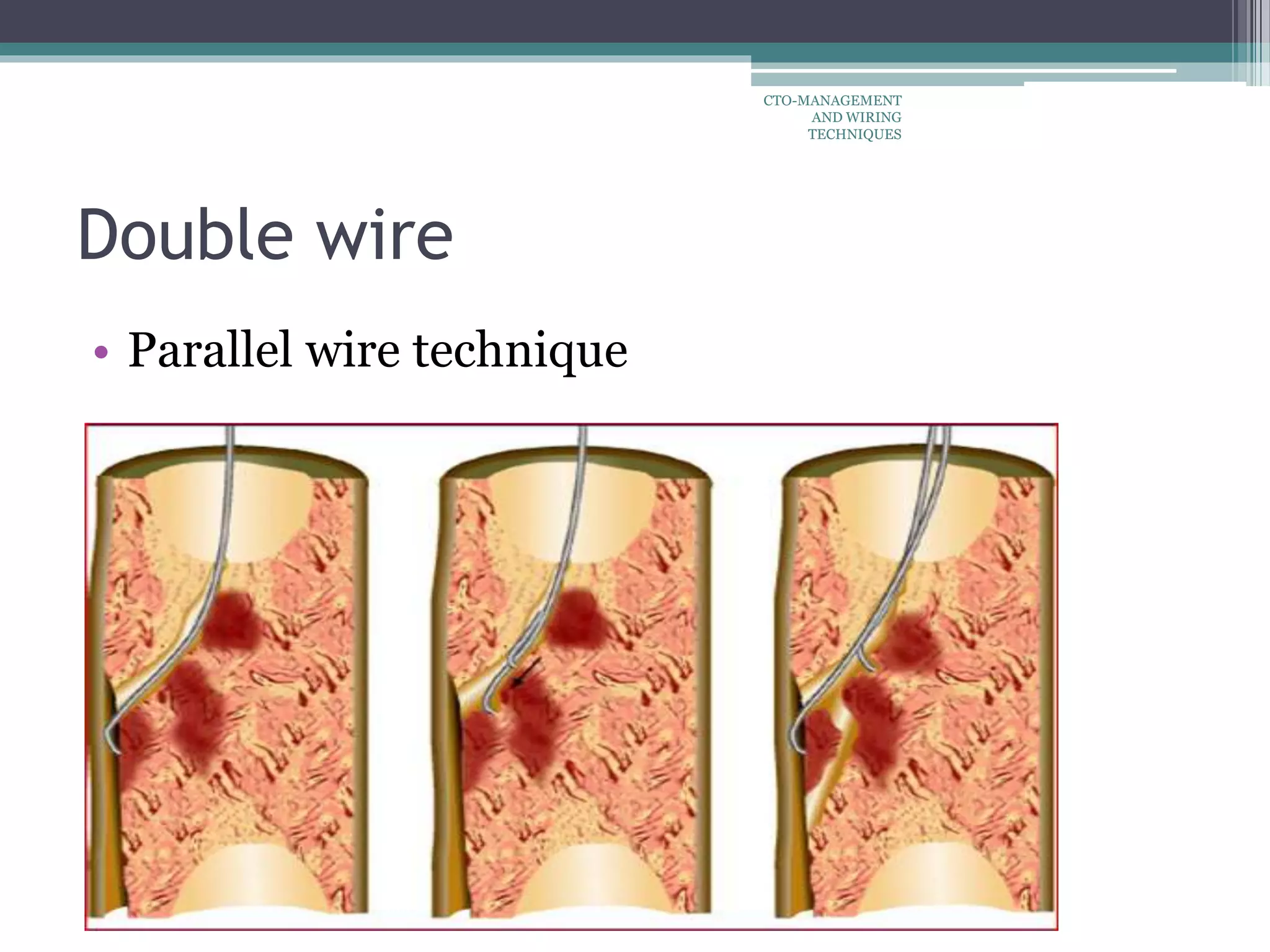 Double wire
• Parallel wire technique
CTO-MANAGEMENT
AND WIRING
TECHNIQUES
 