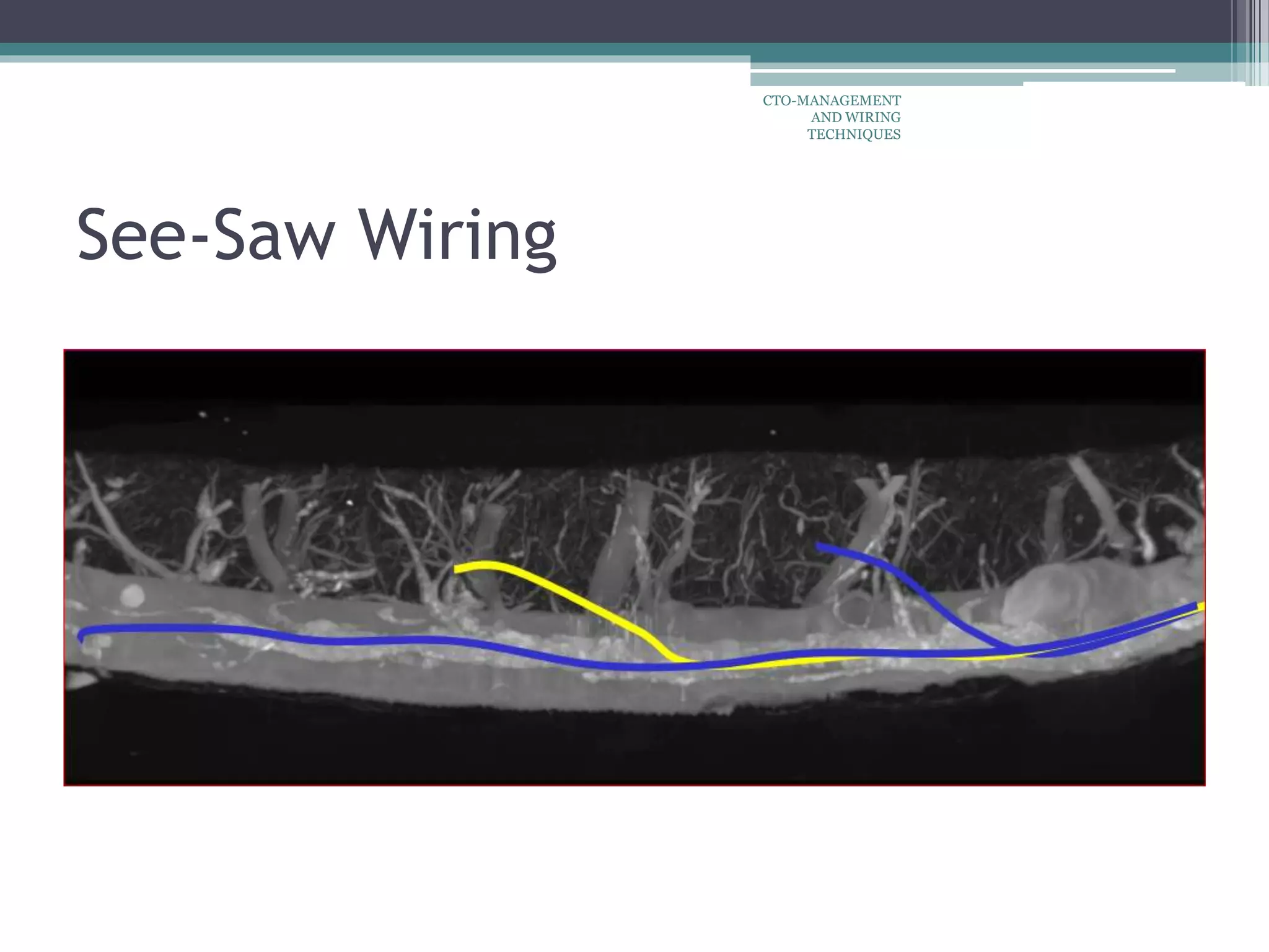 See-Saw Wiring
CTO-MANAGEMENT
AND WIRING
TECHNIQUES
 