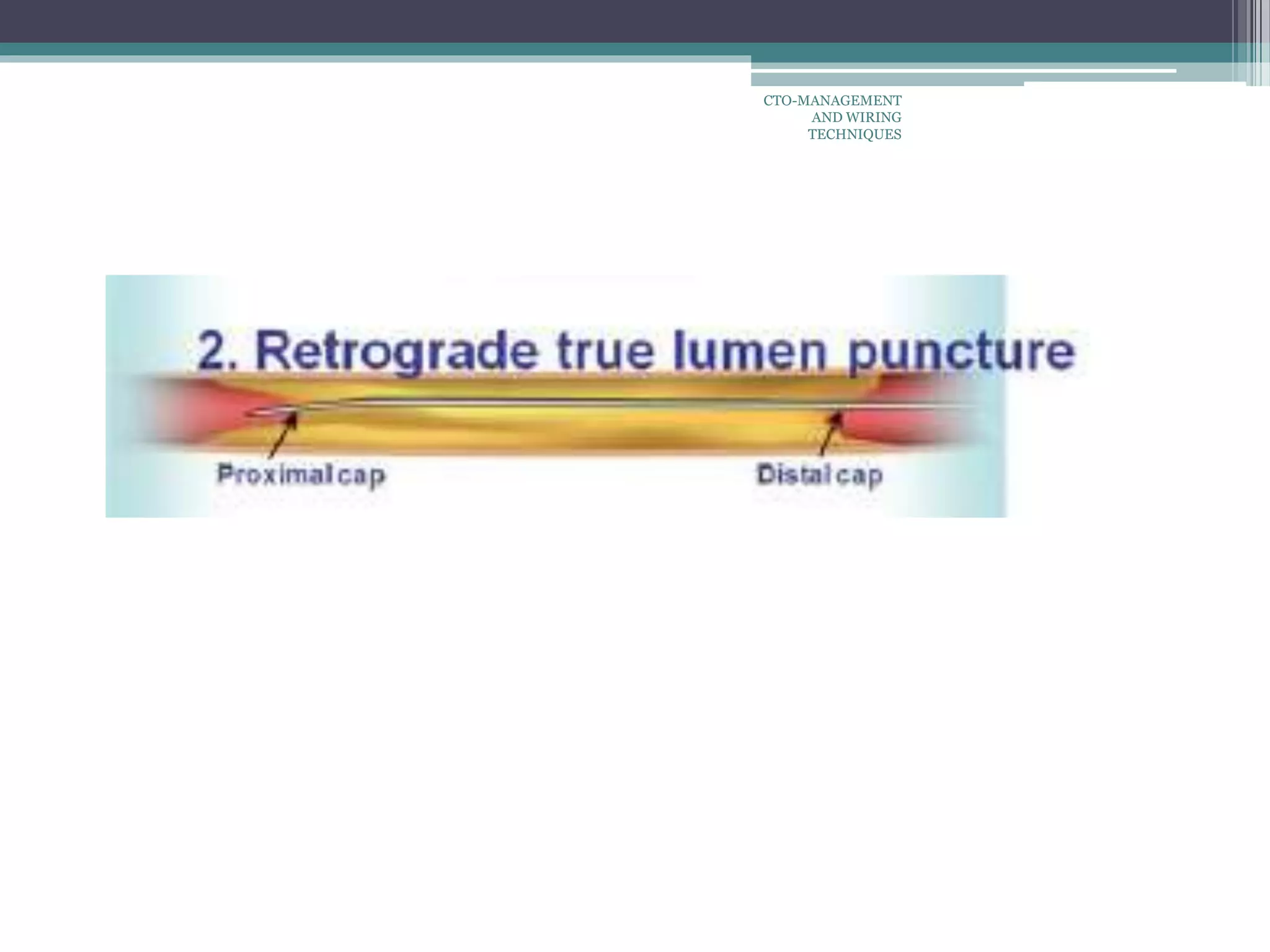CTO-MANAGEMENT
AND WIRING
TECHNIQUES
 