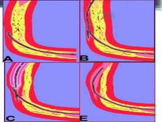 CTO-MANAGEMENT
AND WIRING
TECHNIQUES
 