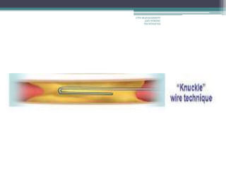 CTO-MANAGEMENT
AND WIRING
TECHNIQUES
 