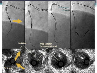 CTO-MANAGEMENT
AND WIRING
TECHNIQUES
 