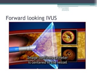 Forward looking IVUS
CTO-MANAGEMENT
AND WIRING
TECHNIQUES
 