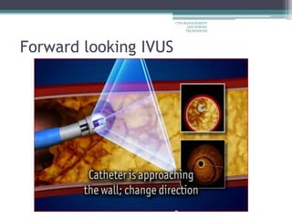 Forward looking IVUS
CTO-MANAGEMENT
AND WIRING
TECHNIQUES
 