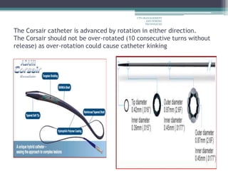 The Corsair catheter is advanced by rotation in either direction.
The Corsair should not be over-rotated (10 consecutive turns without
release) as over-rotation could cause catheter kinking
CTO-MANAGEMENT
AND WIRING
TECHNIQUES
 