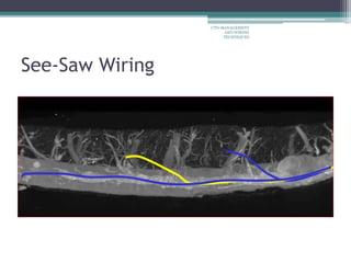 See-Saw Wiring
CTO-MANAGEMENT
AND WIRING
TECHNIQUES
 