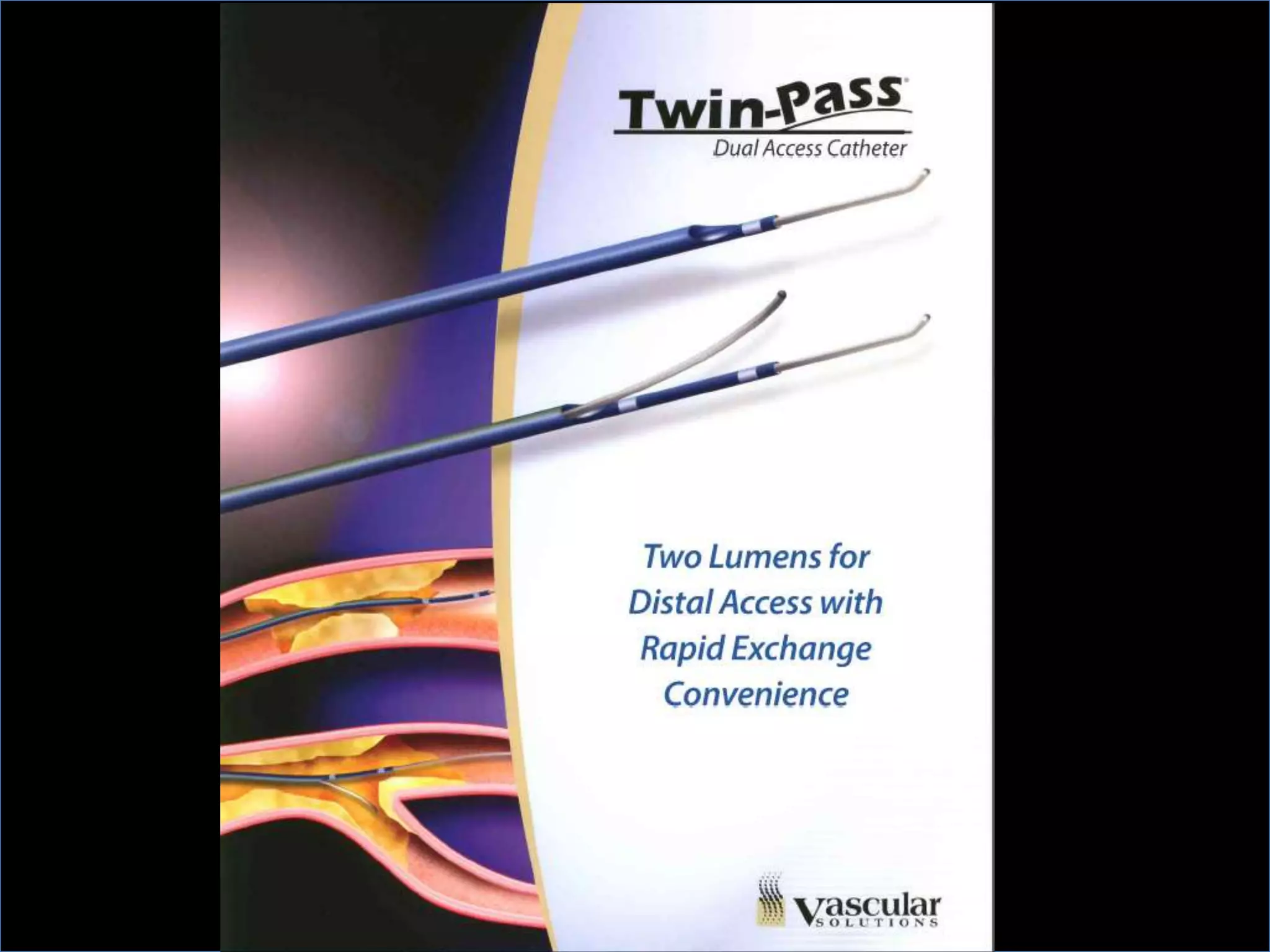 INTERVENTIONAL TECHNIQUES IN CHRONIC TOTAL OCCLUSIONS