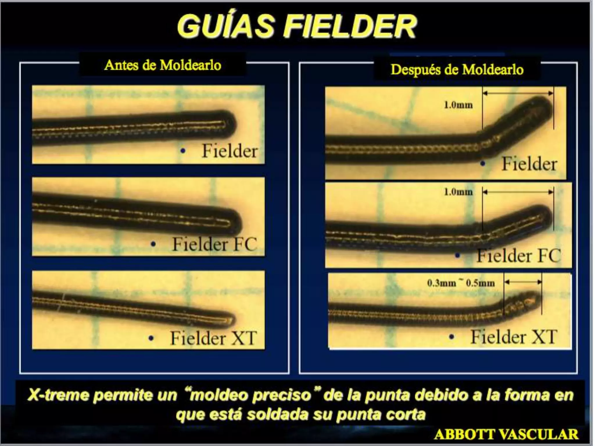 INTERVENTIONAL TECHNIQUES IN CHRONIC TOTAL OCCLUSIONS