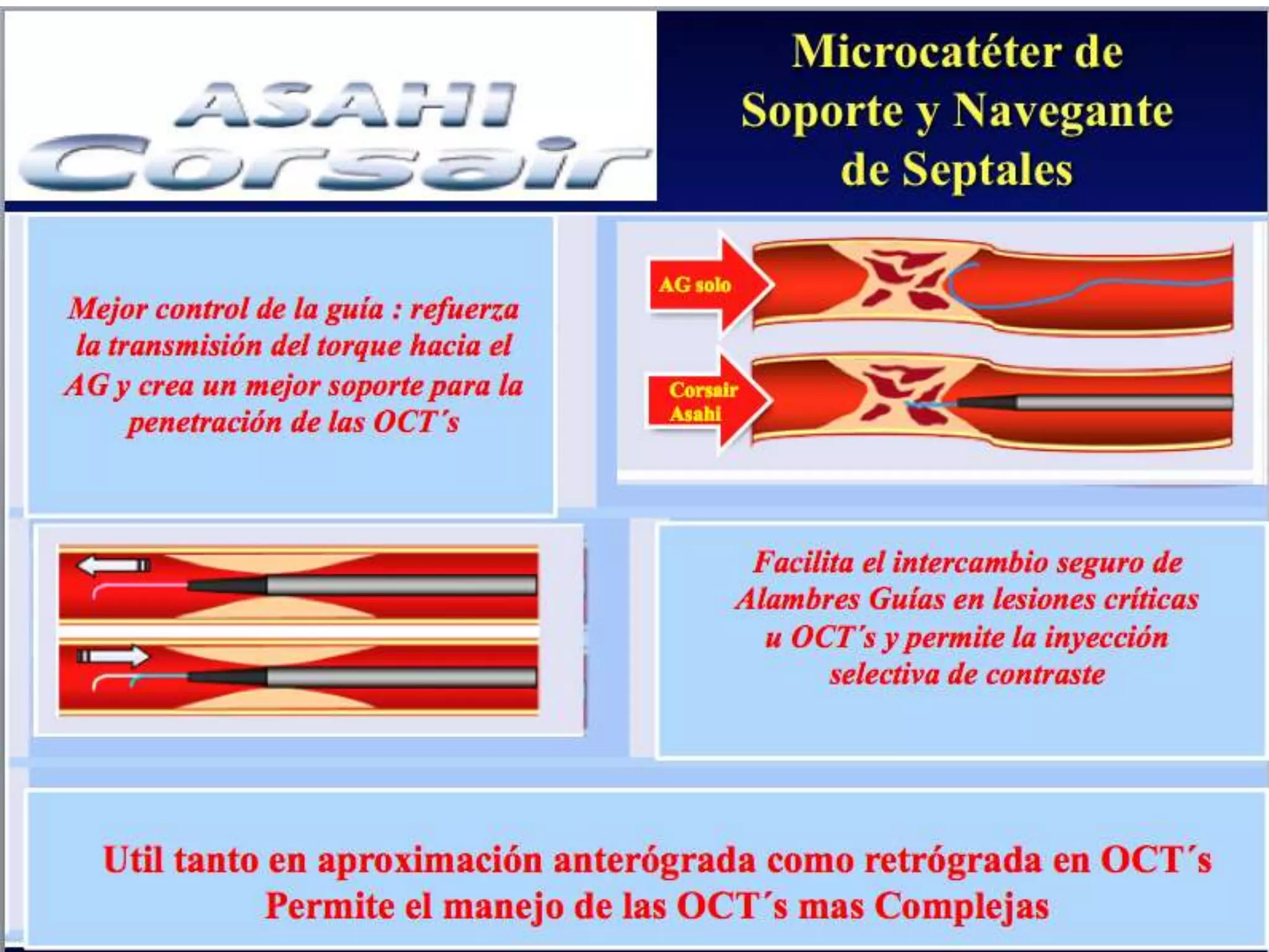 INTERVENTIONAL TECHNIQUES IN CHRONIC TOTAL OCCLUSIONS