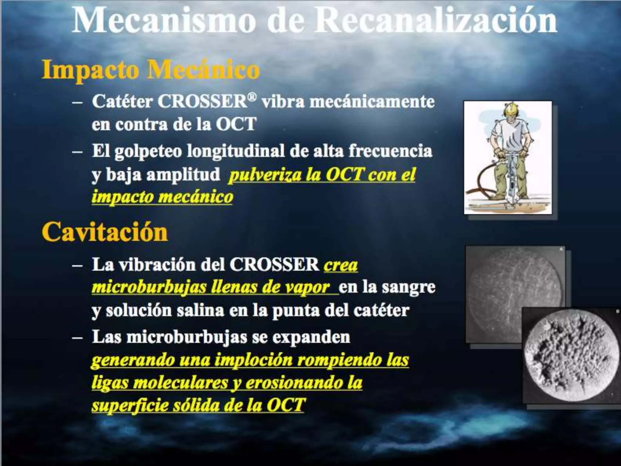 INTERVENTIONAL TECHNIQUES IN CHRONIC TOTAL OCCLUSIONS