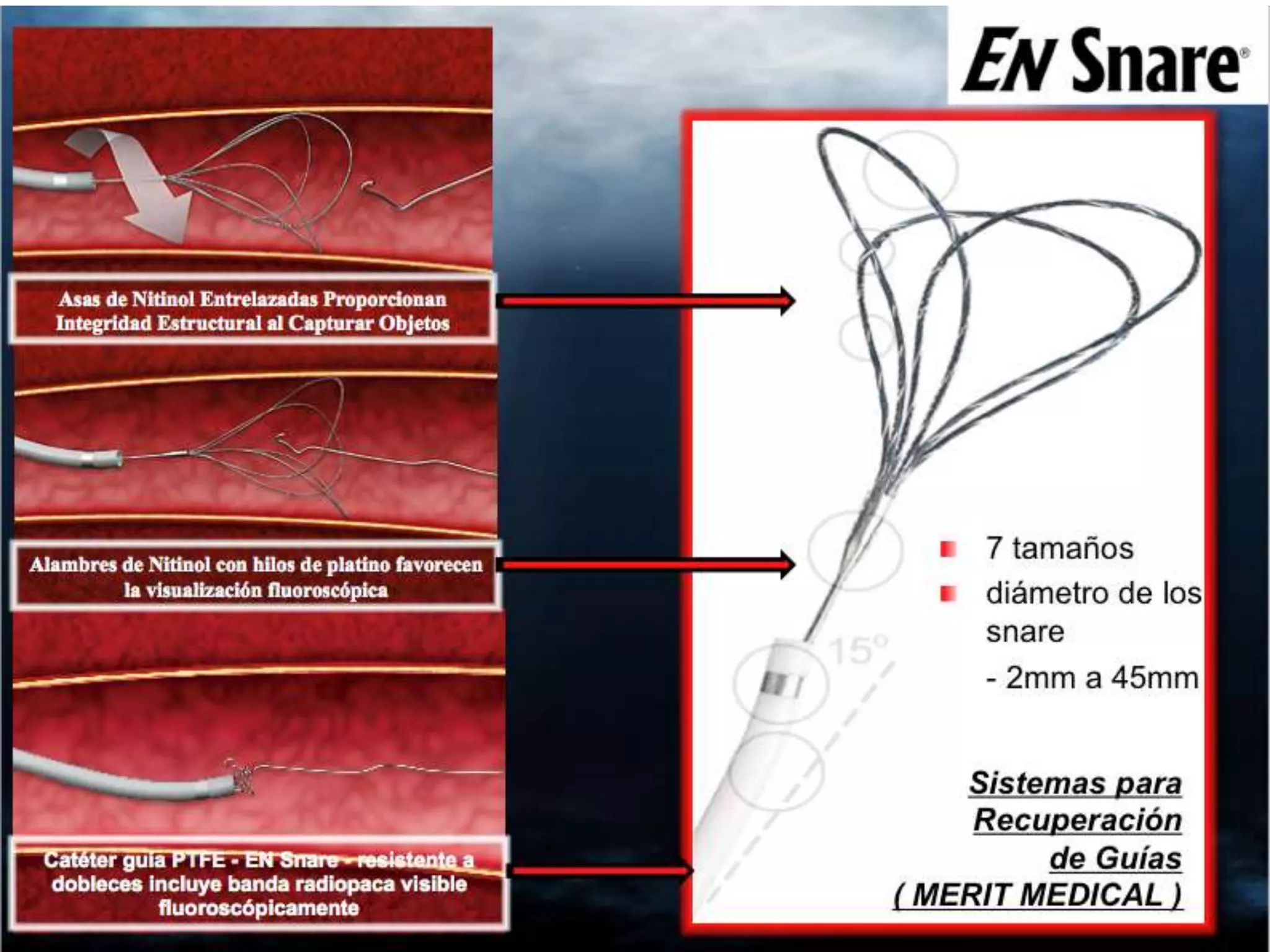 INTERVENTIONAL TECHNIQUES IN CHRONIC TOTAL OCCLUSIONS