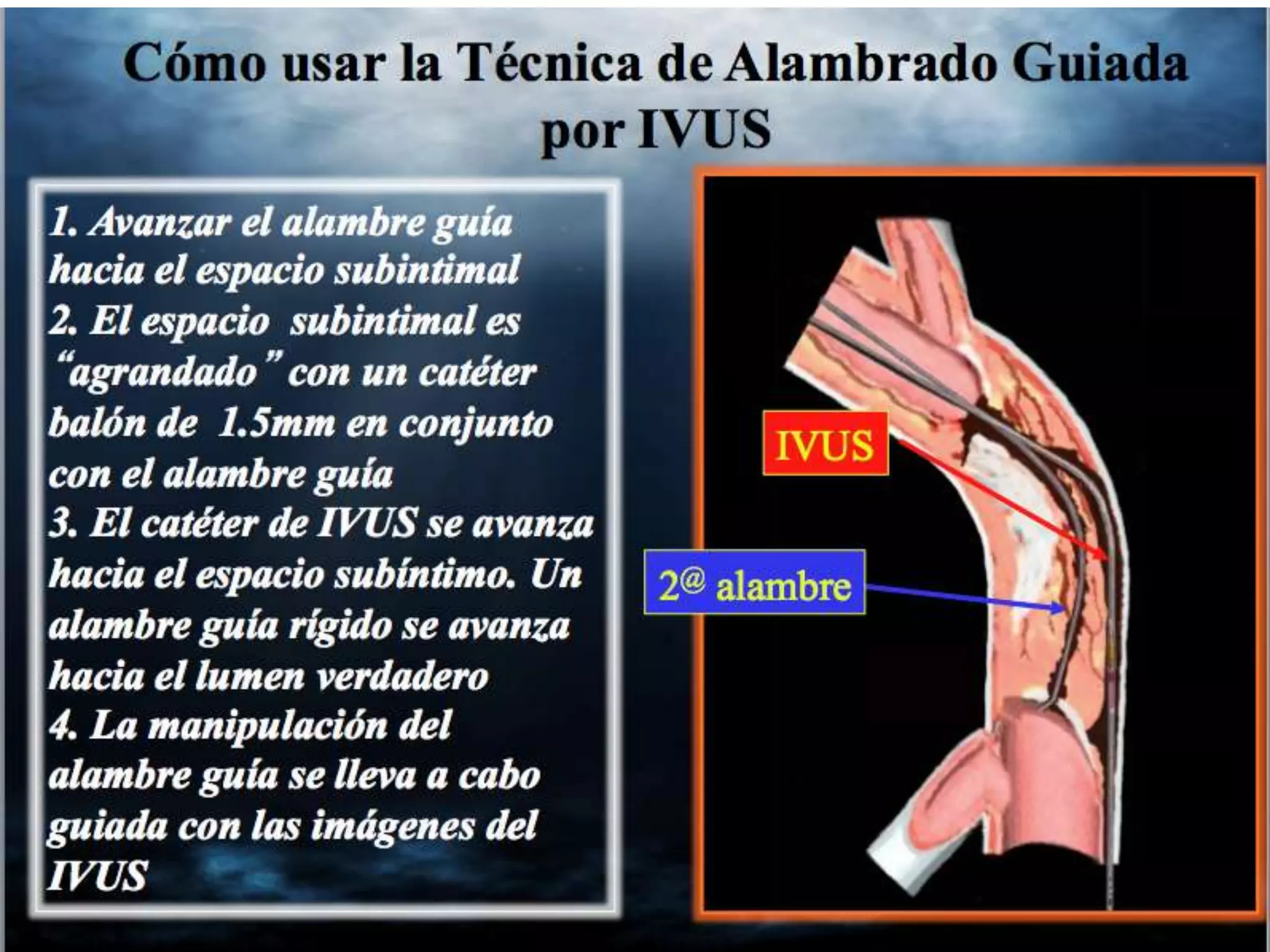 INTERVENTIONAL TECHNIQUES IN CHRONIC TOTAL OCCLUSIONS