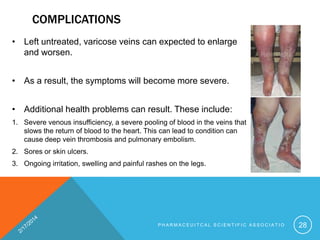 Chronic venous disease | PPTX