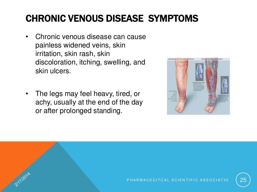 Chronic venous disease