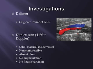  Diagnosis
 CXR –wedge shaped
Oligaemic area/
infarction
 Dilated central vessels
 