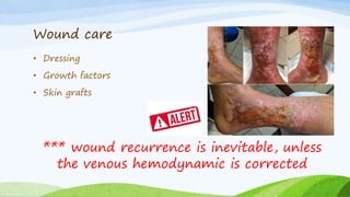 Wound care
• Dressing
• Growth factors
• Skin grafts
*** wound recurrence is inevitable, unless
the venous hemodynamic is corrected
 