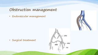 Obstruction management
• Endovascular management
• Surgical treatment
 