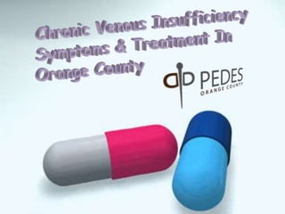 Chronic Venous Insufficiency Symptoms And Treatment